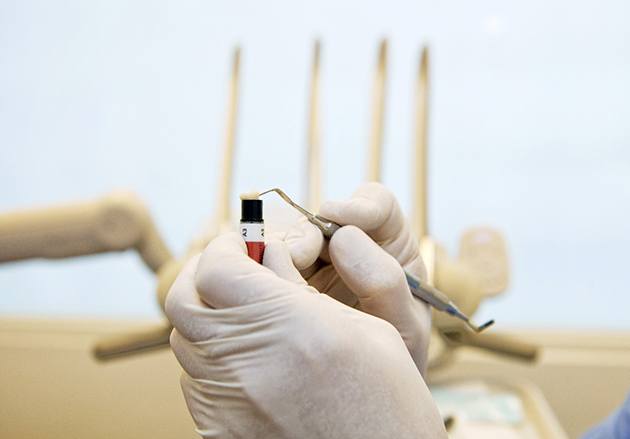 A dental professional using a small dental tool to remove composite resin from a tube in preparation for placement