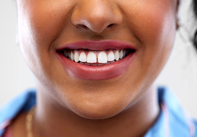 woman smiling with small gaps between her teeth