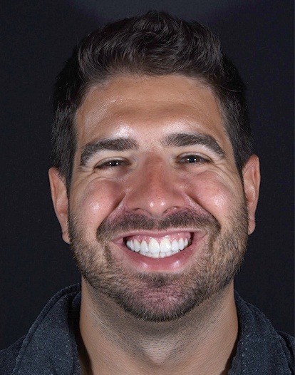 Man in gray jacket grinning