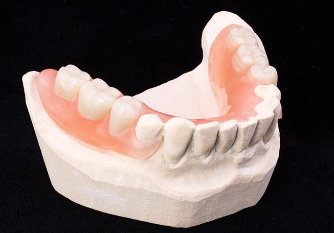 Partial denture in Plainview