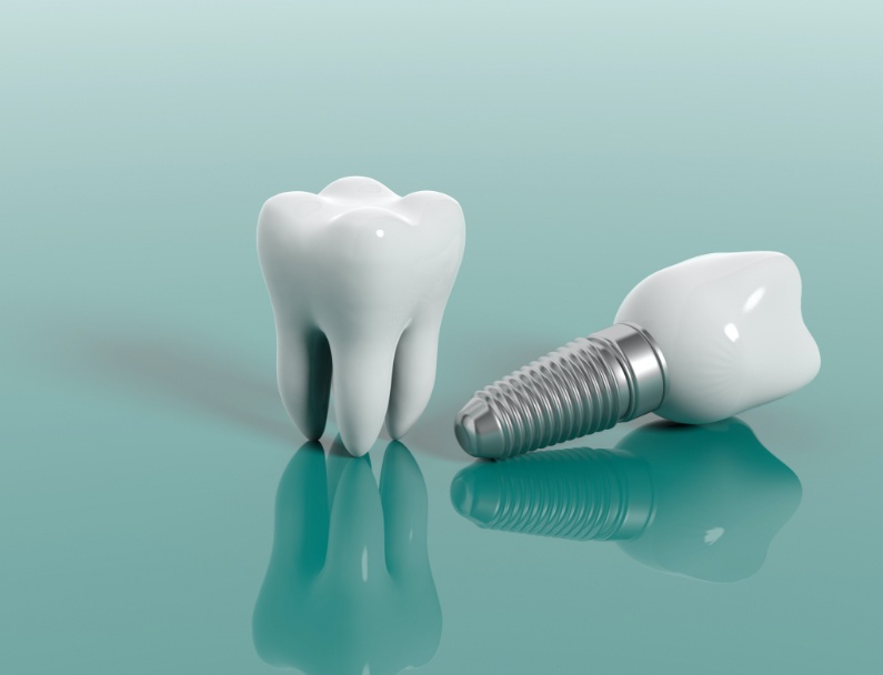 real tooth next to a dental implant in Plainview