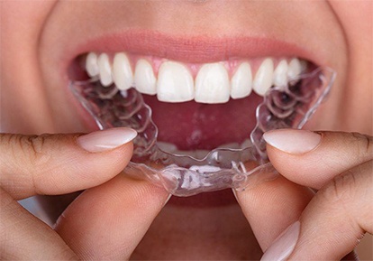 person putting a mouthguard over their teeth