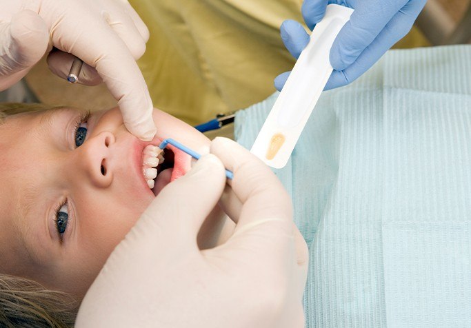 young boy getting fluoride treatment