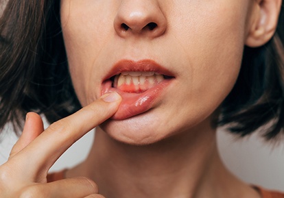 Woman pointing to her gums