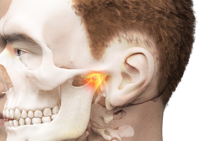 Illustration of a head highlighting the jaw joints