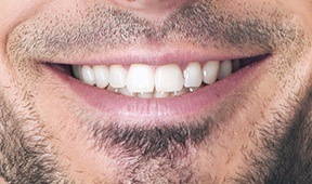 Close up view of front of man smiling