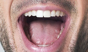 Close up of front view of man smiling with mouth wide open