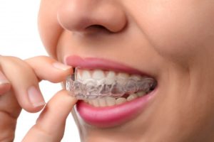 woman smiling inserting Invisalign tray