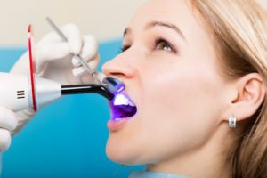 woman mouth open receiving dental bonding