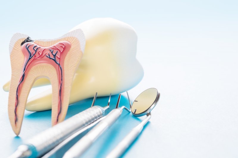 dentist holding a model of a decayed tooth